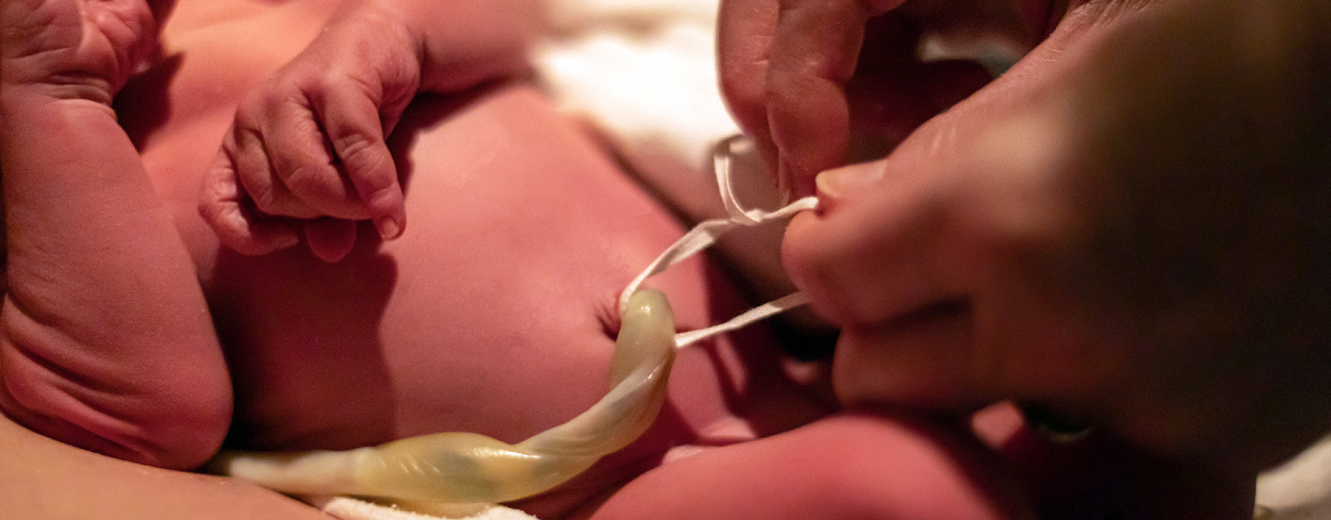 Cutting Of The Umbilical Cord Stock Photo - Download Image Now